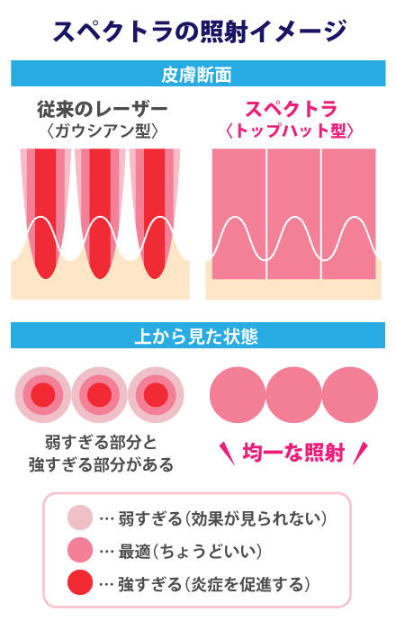 スペクトラ照射イメージ