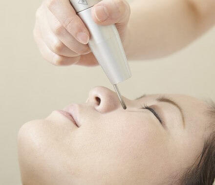 QスイッチYAGレーザー照射の様子