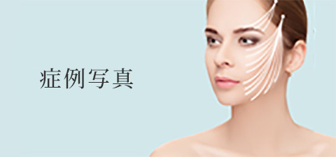 症例紹介