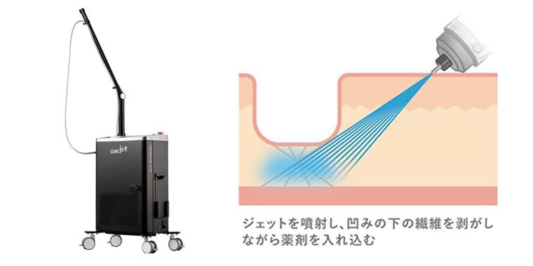キュアジェット「マイクロサブシジョン」と「ダーマペン4」の違い