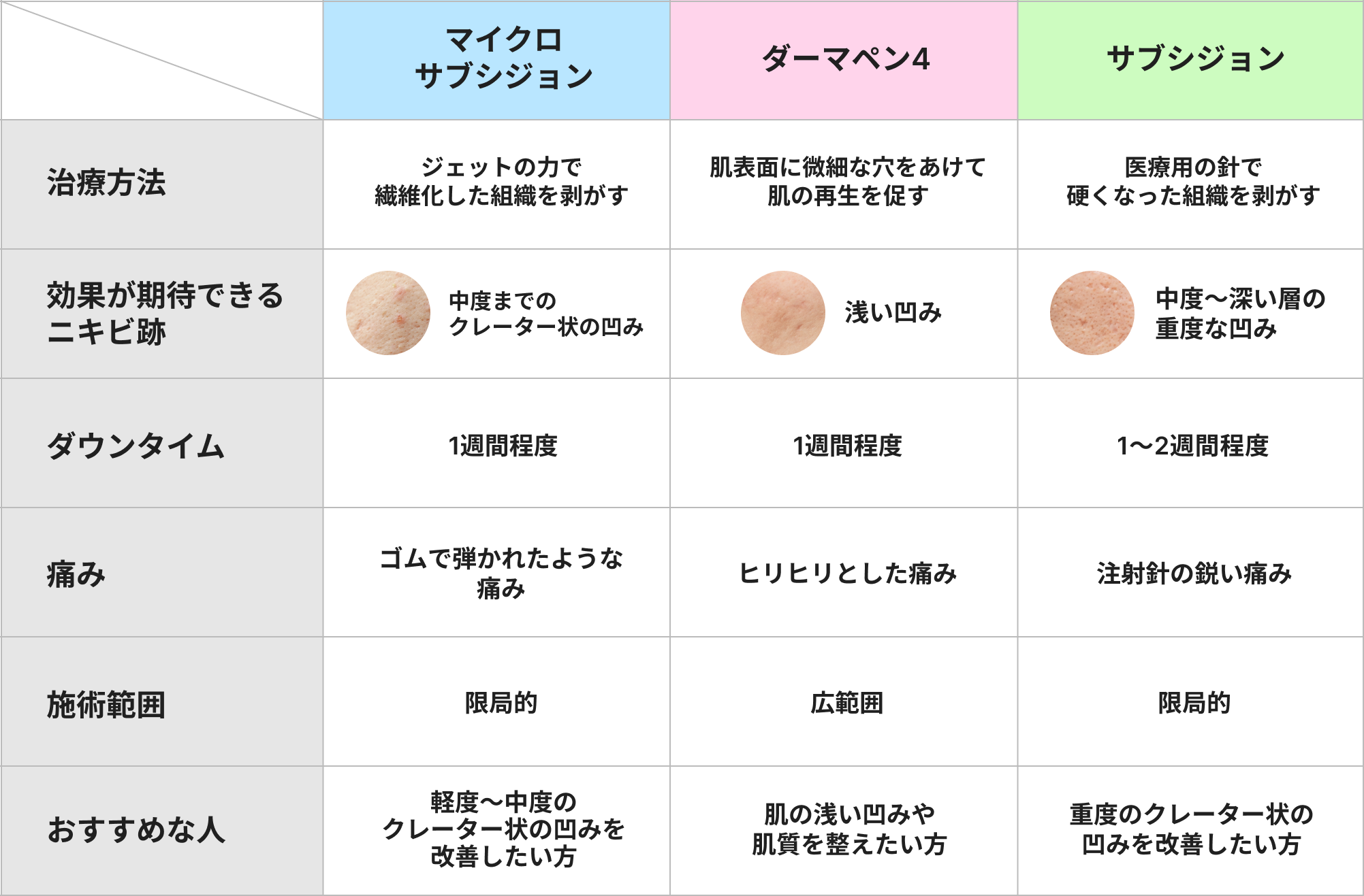 「マイクロサブシジョン」「ダーマペン4」「サブシジョン」自分に合う治療法は？