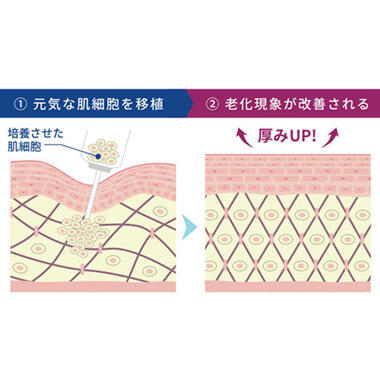 再生医療は、減った肌細胞を増やす治療