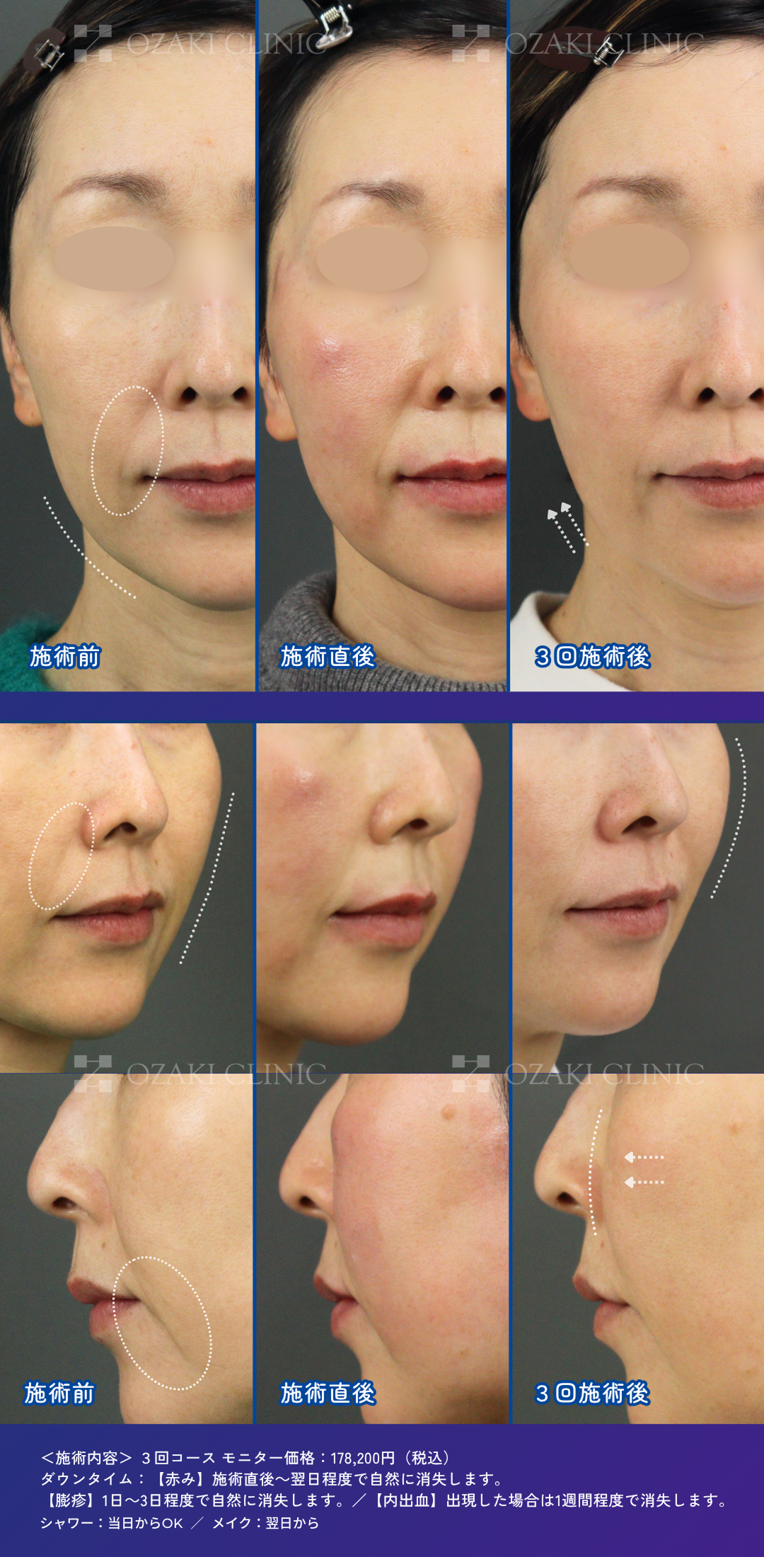 column_aging-care12_contents0203_.png