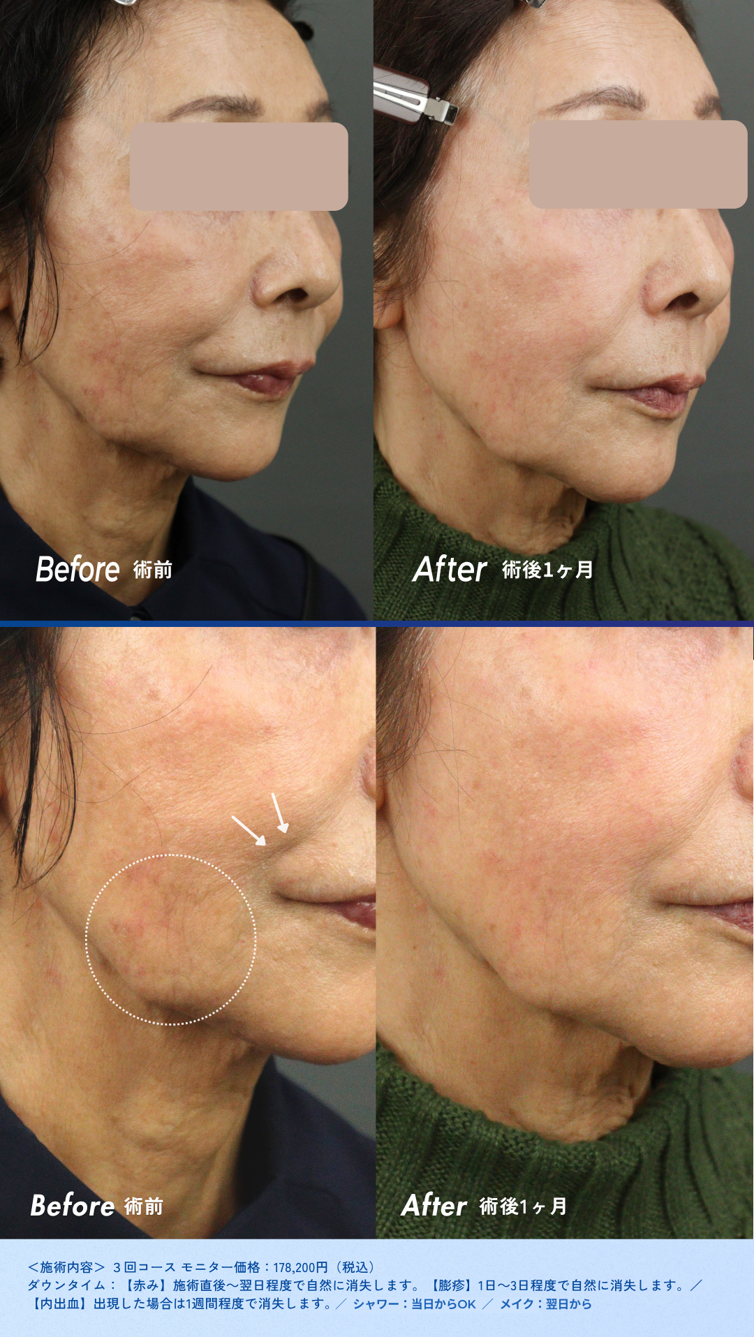 column_aging-care12_contents0607_.png