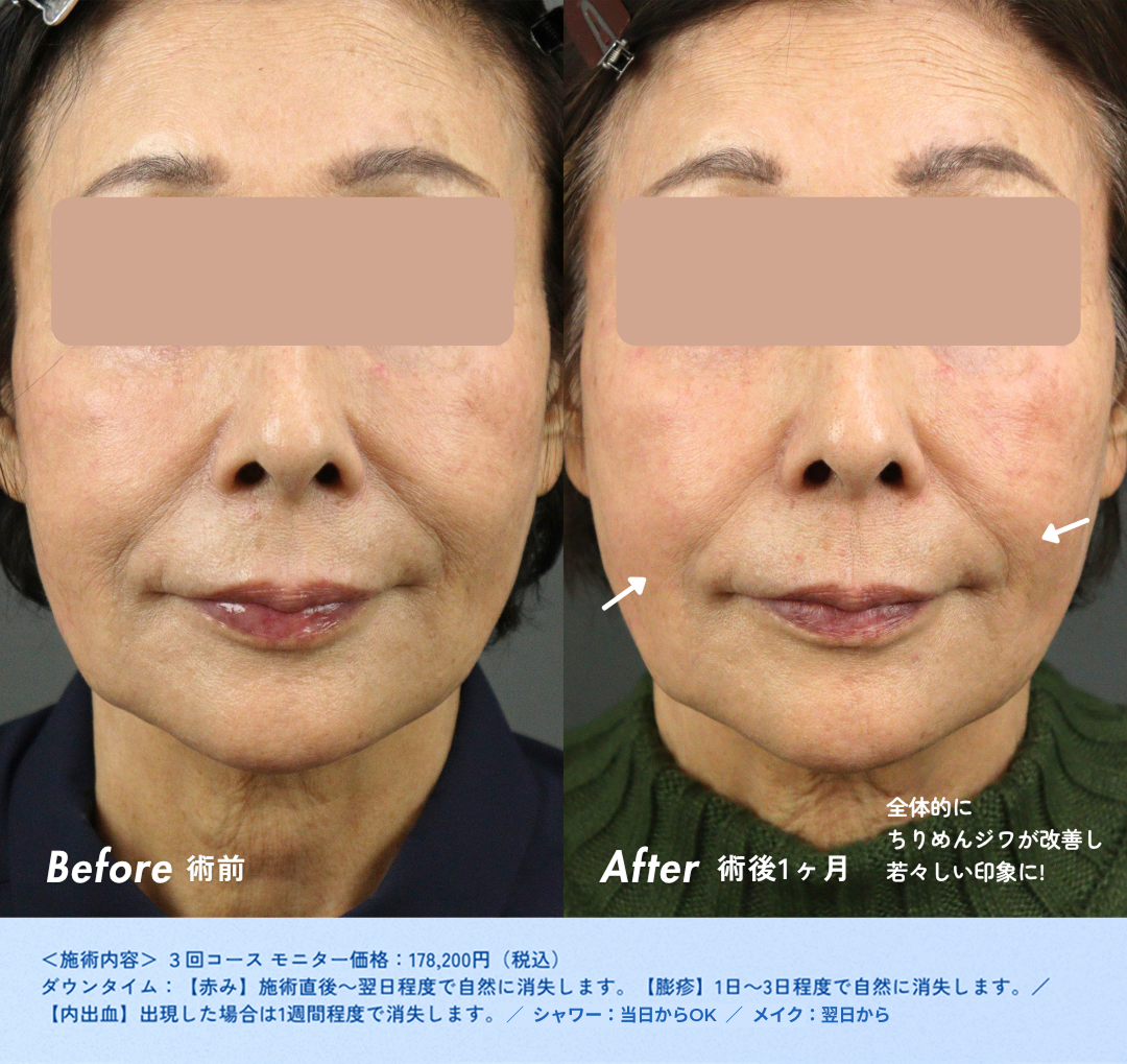 column_aging-care12_contents08_.png