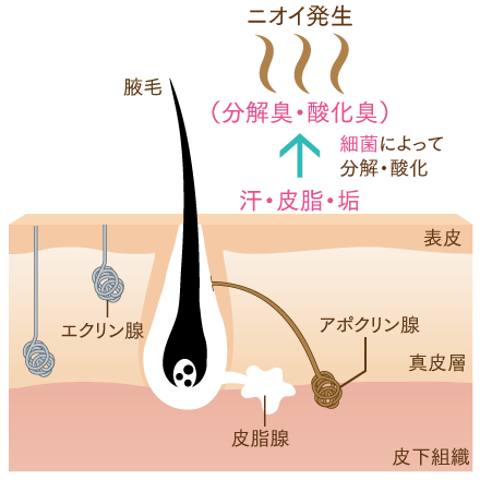 ワキガとは？