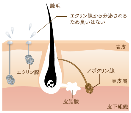 多汗症とは？