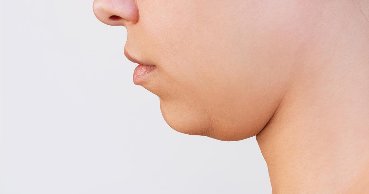 脂肪吸引を検討中の方へ｜事故のリスクと後悔しないクリニック選び