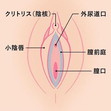 膣前庭部疼痛粘膜切除術