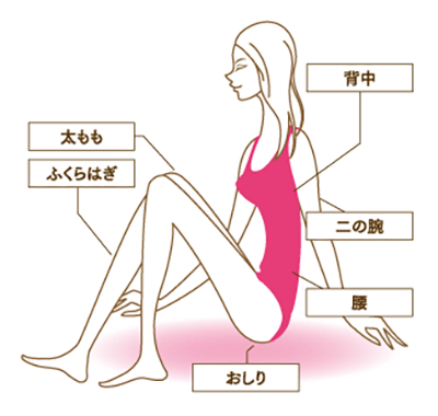 毛孔性苔癬ができやすい部位