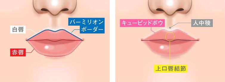 唇ヒアルロン酸注射はどこに打つ？