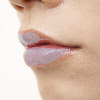 唇ヒアルロン酸注射の失敗やデメリット4：ヒアルロン酸が青白く透けて見えてしまう