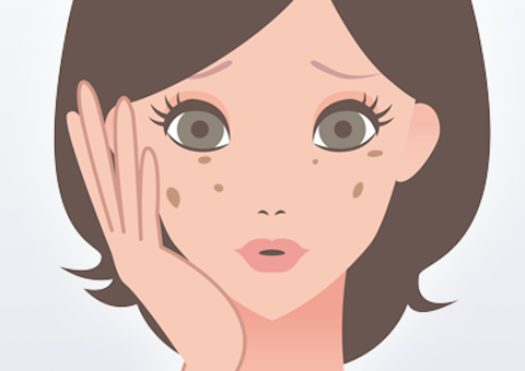 気になる顔のシミは年齢のせい？加齢シミの原因とおすすめ治療法