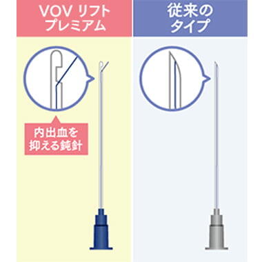 ダウンタイムが短い