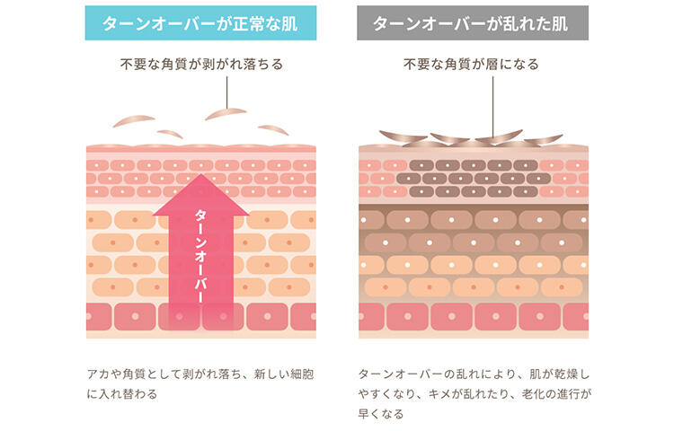 ターンオーバーの乱れとは
