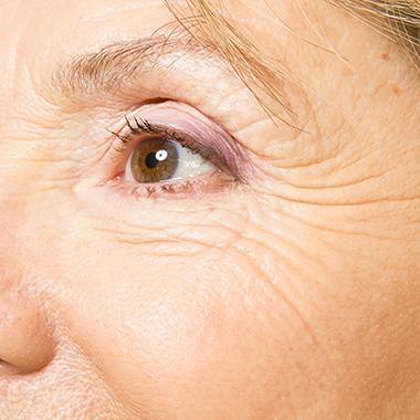 5.ECM製剤が向いている人:乾燥・小ジワ・ハリ感を底上げしたい