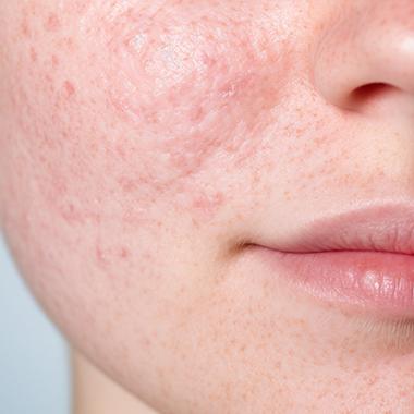 6.PN製剤が向いている人:ダメージ感・ゆらぎを整えたい