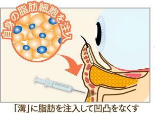 「皮下脂肪の減少」をボリュームアップ