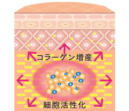 3Dリポアイリフト・3Dパーフェクトアイリフトの特長2：コラーゲン増産効果で肌ツヤもアップ！