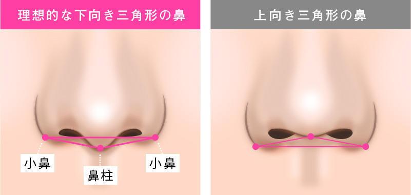 ACRが整っている図、整っていない図