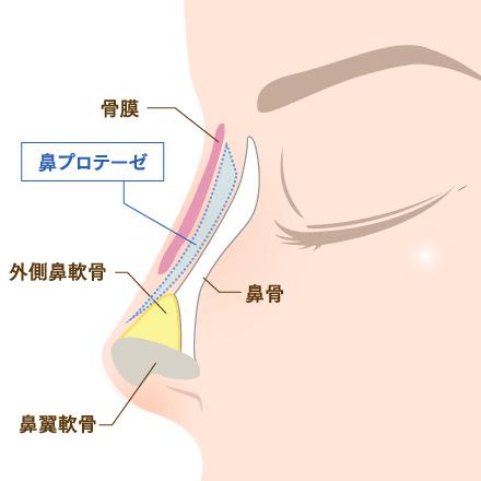 column_nose05_contents16.jpg