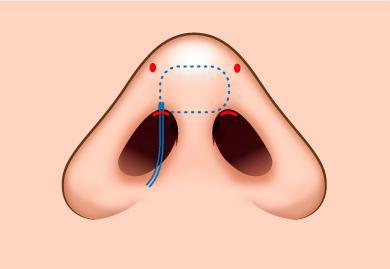 column_nose05_contents18.jpg