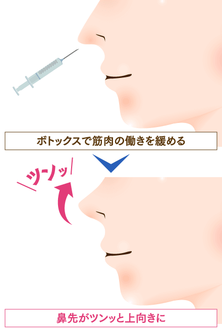 column_nose05_contents20.png