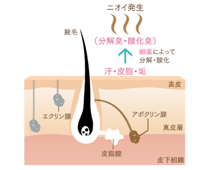 ワキガのニオイ対策法