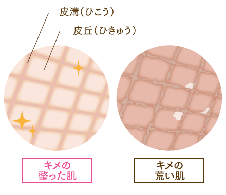 「きめ」が乱れている