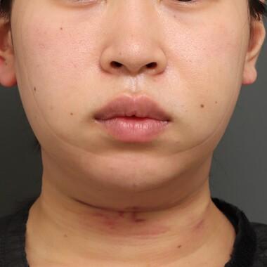 column_puchi-face26_contents04.jpg