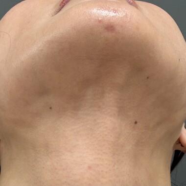 column_puchi-face26_contents05.jpg