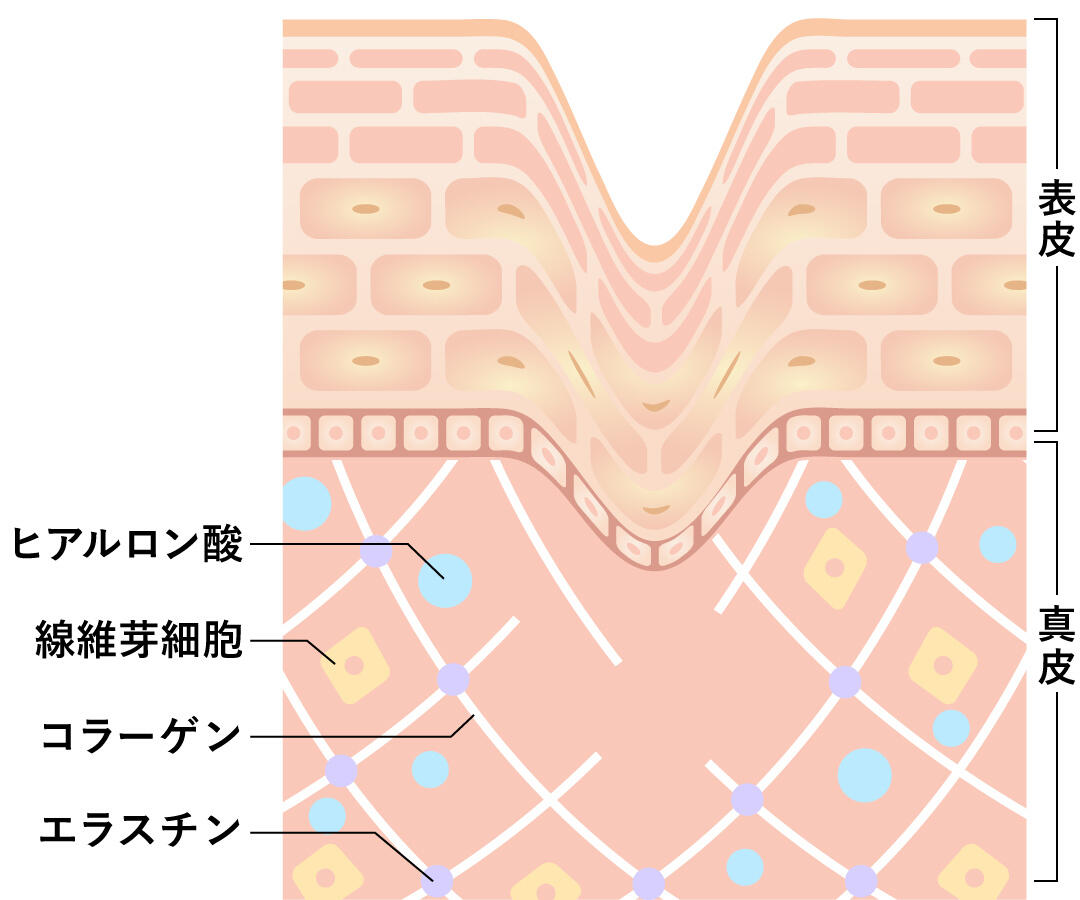 顔のたるみ1:真皮のたるみ