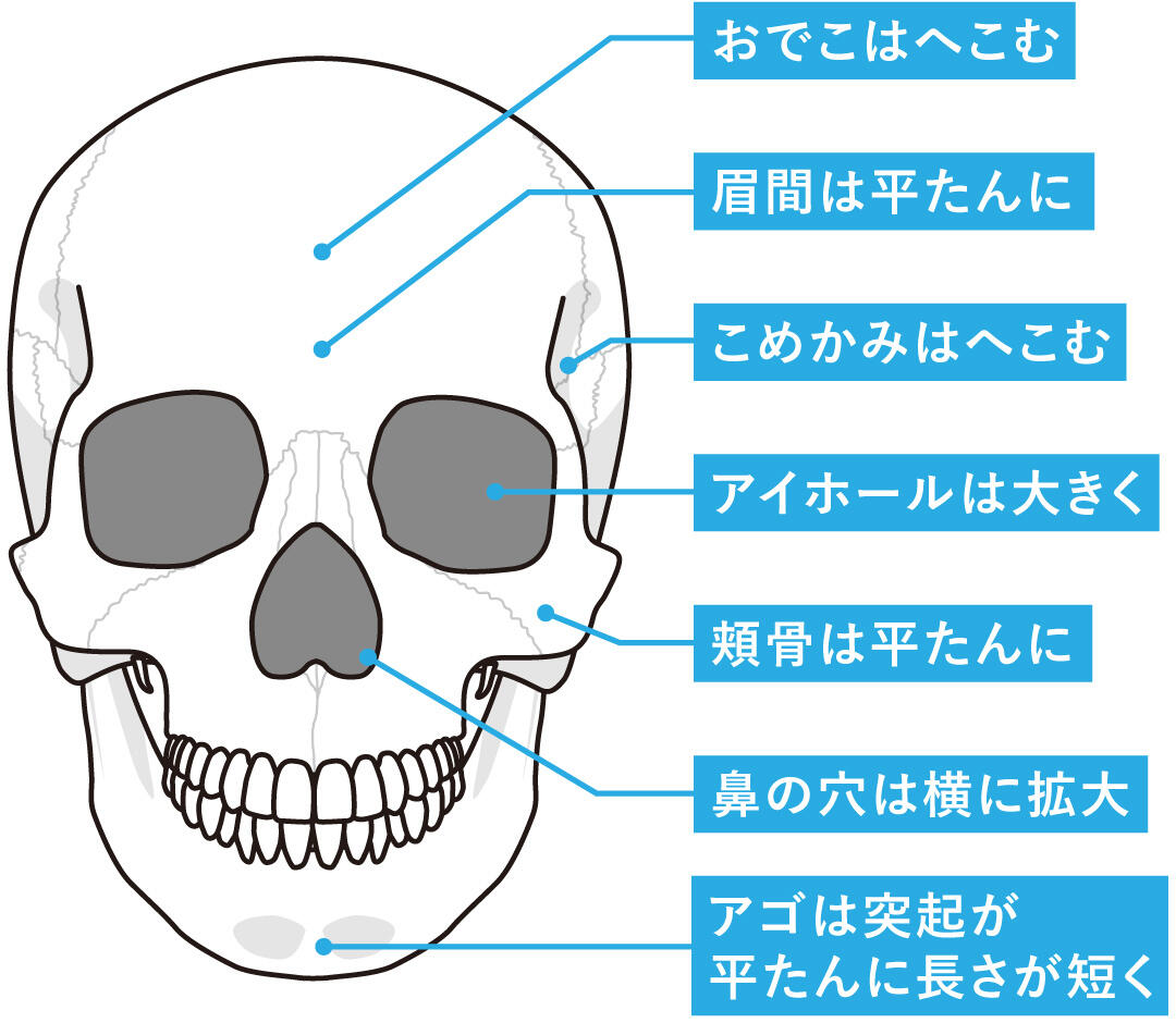 顔のたるみ5：骨の萎縮によるたるみ