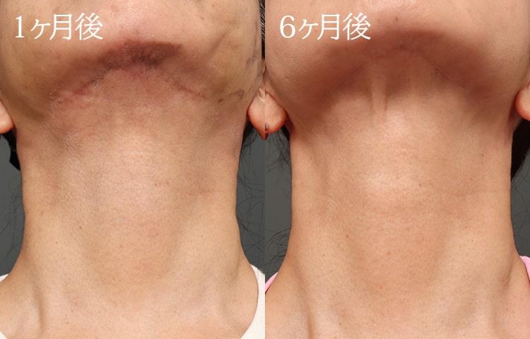 ビフォーアフター比較