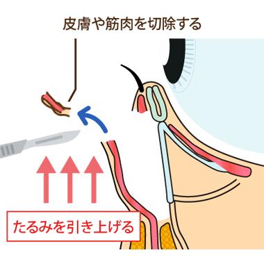 長期的な効果！