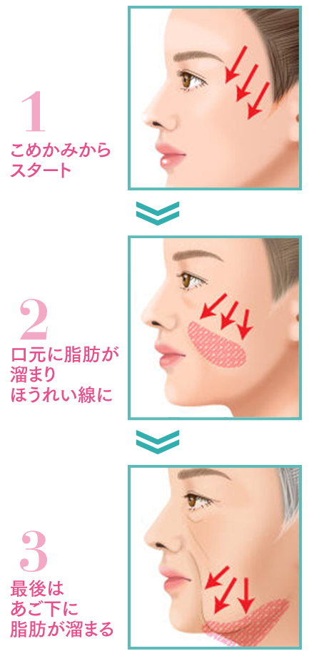 顔のたるみは重力に負けて垂れてきた脂肪?