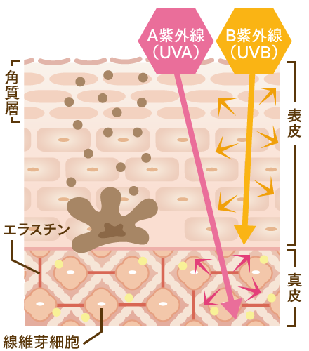 その1.紫外線A波はシワ、たるみ、B波はシミ、そばかすの原因に