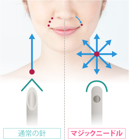 小鼻の根元はしっかりと