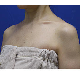 40代女性のその他 After 症例写真