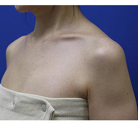 40代女性のその他 Before 症例写真