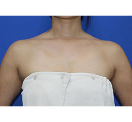 40代女性のその他 After 症例写真