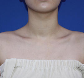 20代女性のその他 After 症例写真