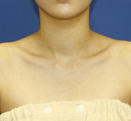 20代女性のその他 Before 症例写真