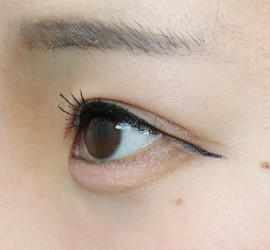 20代女性の眼瞼下垂 Before 症例写真