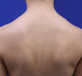 30代女性のその他 After 症例写真