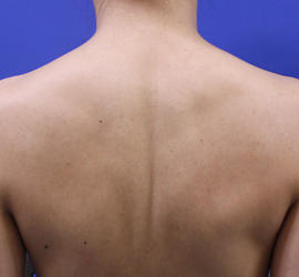 30代女性のその他 Before 症例写真