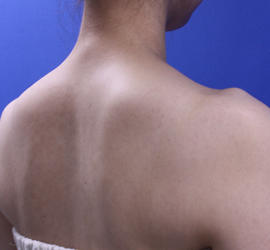 30代女性のその他 After 症例写真