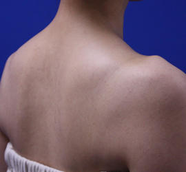 30代女性のその他 Before 症例写真