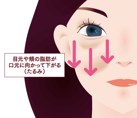 皮下脂肪の減少のイメージ