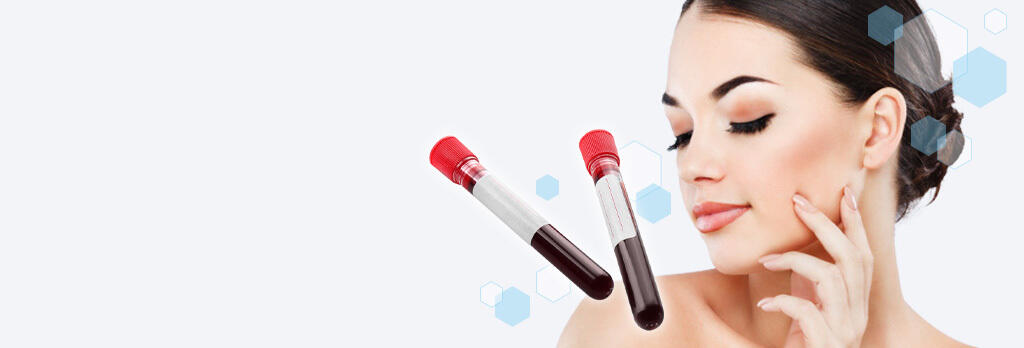 ACRS（自己血サイトカインリッチ血清） autologous-cytokine-rich-serum